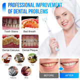Electric Sonic Teeth Cleaning Kit