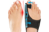 1 Pair Bunion Corrector Adjustable Orthopedic Toe Separator