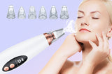 Blackhead Remover Vacuum – 6-Level Pore Cleaner Suction Tool!