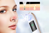 Electric Blackhead Remover Vacuum Face Pore Cleaner with 6 Suction Heads