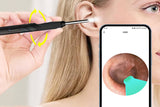 Wireless Otoscope Ear Wax Remover