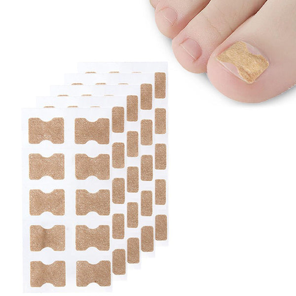 100Pcs Toenail Ingrown Correction Stickers