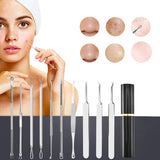 10 Pcs Black Head Remover Pimple Popper Tool Kit