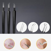 10 Pcs Black Head Remover Pimple Popper Tool Kit